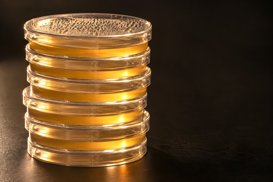 Stack of Petri Dishes Filled with Amber Agar Growth Medium, Backlit Against a Dark Background