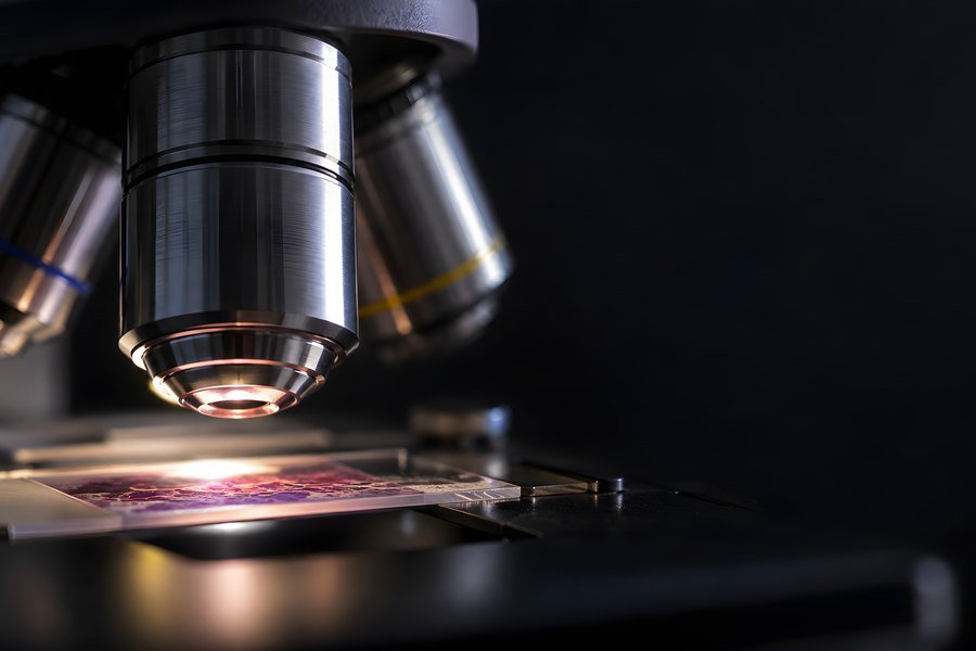 Microscope objective lenses focused on a stained specimen slide, close-up with no people